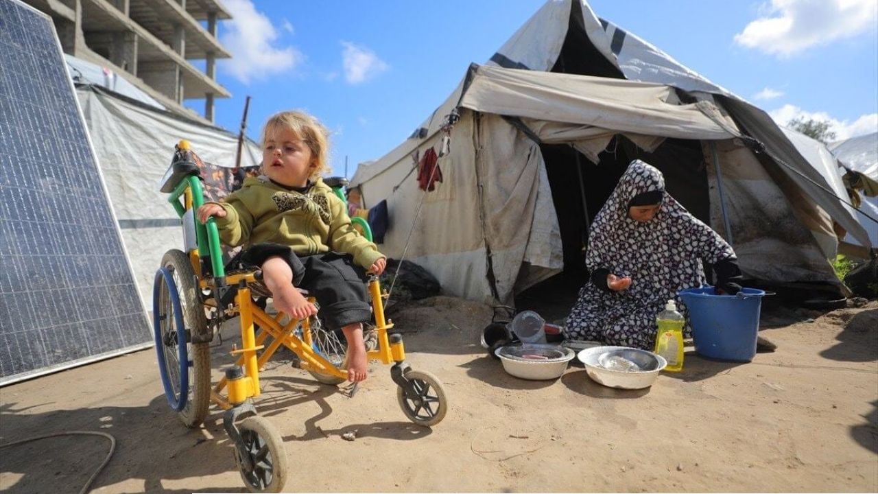 ইজরায়েলি হামলায় পঙ্গু ৪ বছরের কামার: উন্নত চিকিৎসার অপেক্ষায় প্রহর গুনছে এক ফিলিস্তিনি শিশু