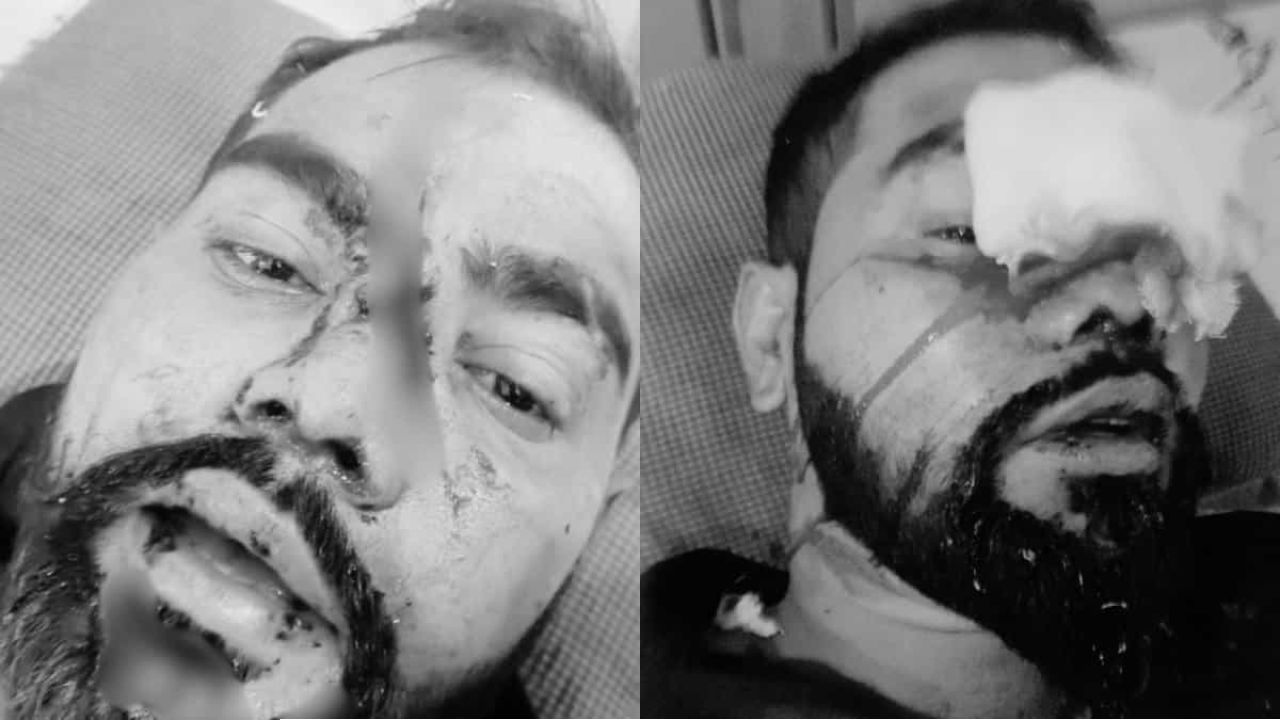 মহারাষ্ট্রে মহাসড়কে মুসলিম পরিবহন শ্রমিকদের ওপর সশস্ত্র হামলা: দুইজনের অবস্থা আশঙ্কাজনক